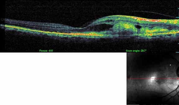 Mulamoottil Eye Hospital, Eye Care, Lasik, Cataract, Laser, Kozhencherry, Pathanamthitta, Kerala, India