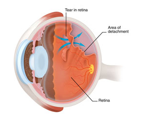 Mulamoottil Eye Hospital, Eye Care, Lasik, Cataract, Laser, Kozhencherry, Pathanamthitta, Kerala, India