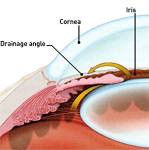 Mulamoottil Eye Hospital, Eye Care, Lasik, Cataract, Laser, Kozhencherry, Pathanamthitta, Kerala, India