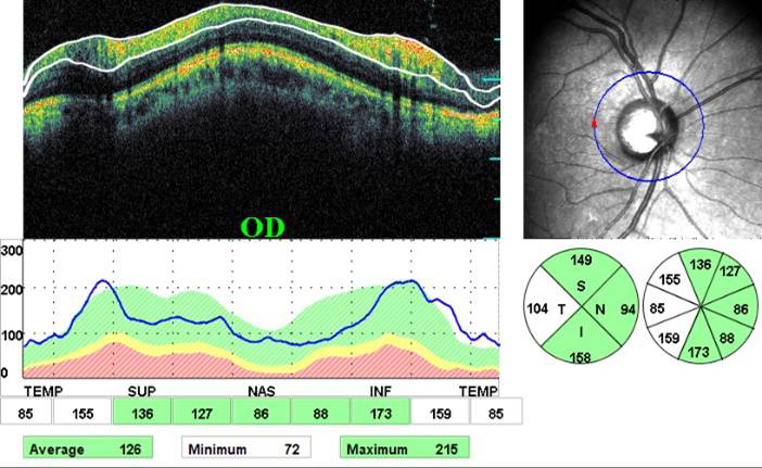 Mulamoottil Eye Hospital, Eye Care, Lasik, Cataract, Laser, Kozhencherry, Pathanamthitta, Kerala, India