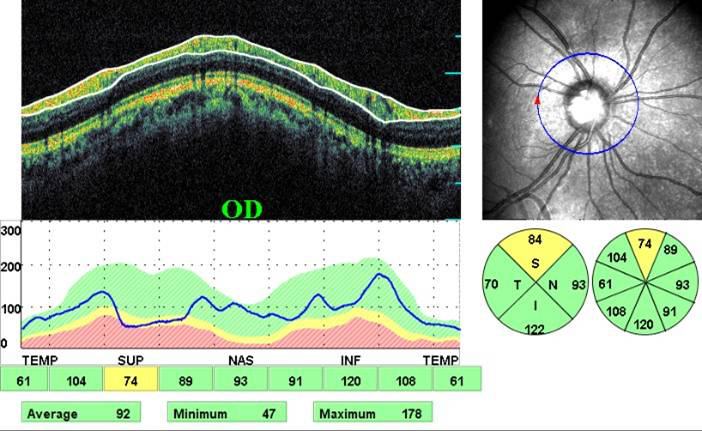 Mulamoottil Eye Hospital, Eye Care, Lasik, Cataract, Laser, Kozhencherry, Pathanamthitta, Kerala, India