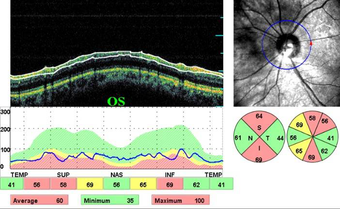 Mulamoottil Eye Hospital, Eye Care, Lasik, Cataract, Laser, Kozhencherry, Pathanamthitta, Kerala, India